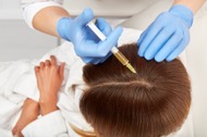 What happens during PRP Hair Restoration? 